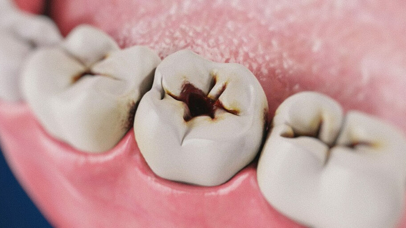 Стоматология Премоляр