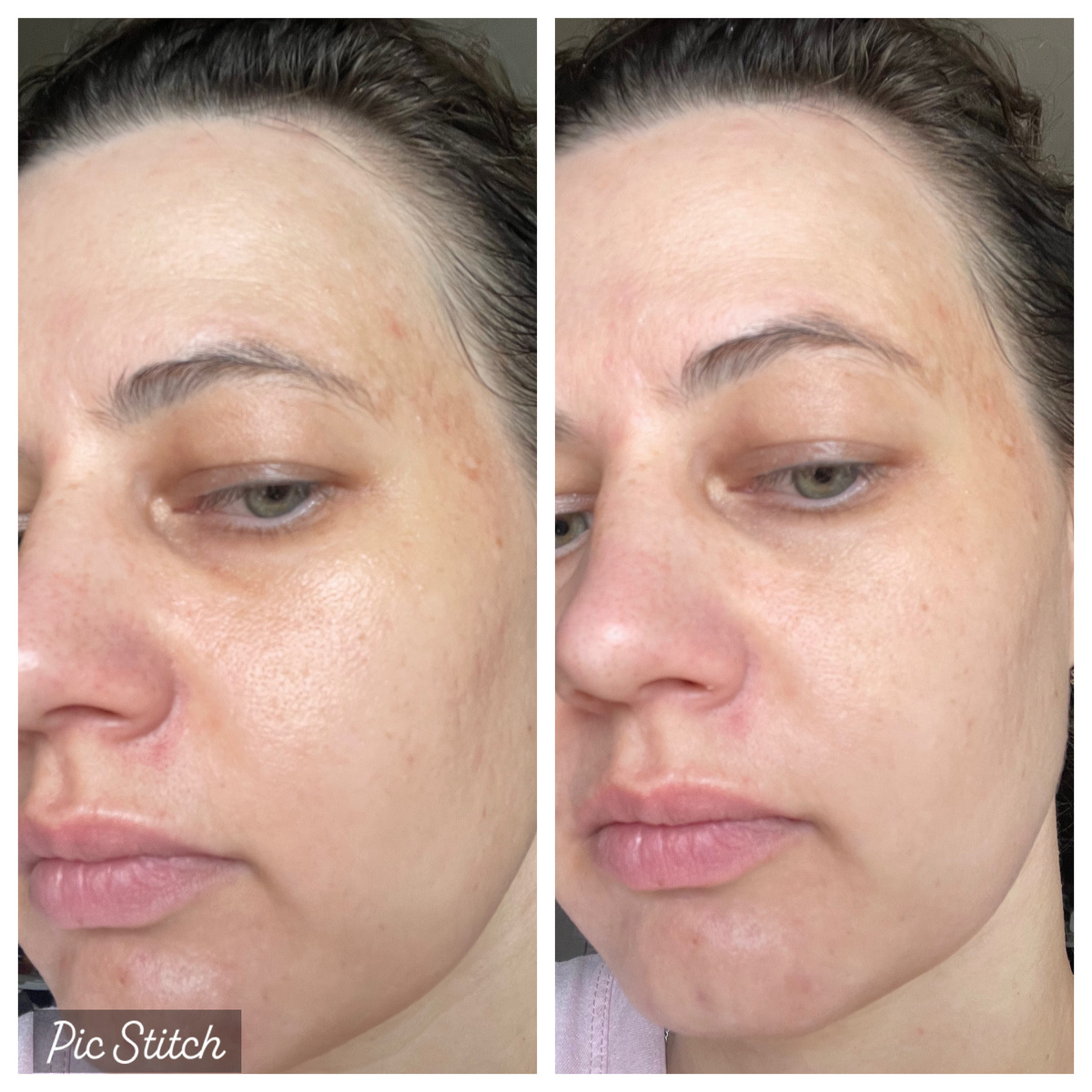 Фото слева - чистая кожа, фото справа - с праймером.