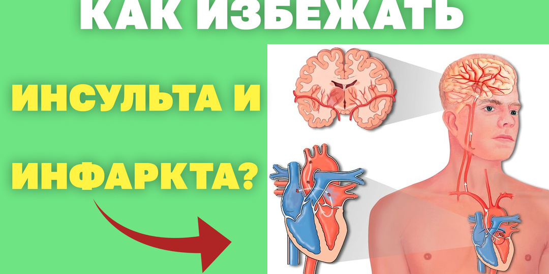 Инфаркт: 10 минут, которые решают судьбу