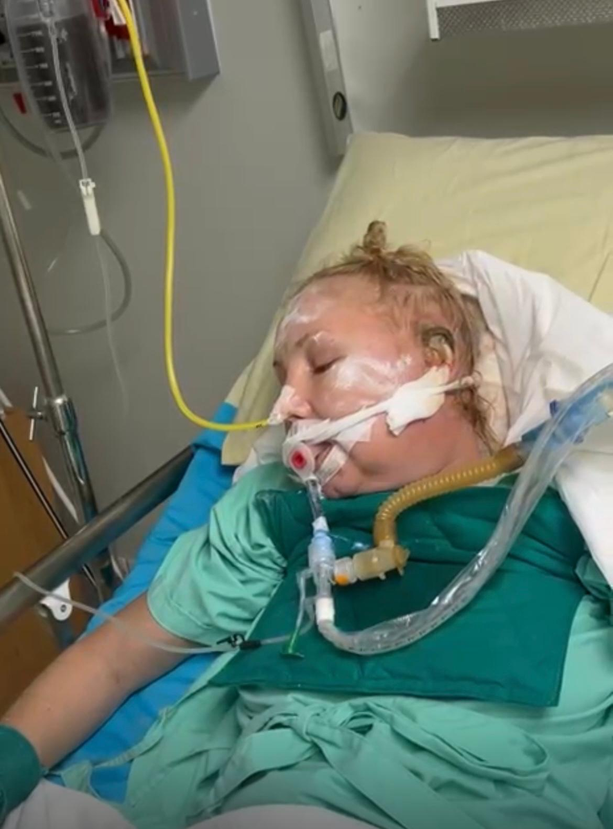 Черное ухо, массивная гематома в черепной коробке - следствие падения. 