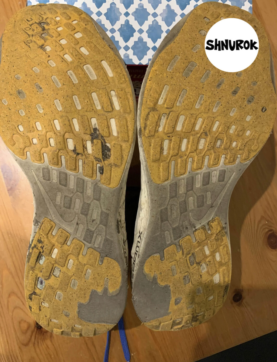 Стопа слишком сильно заваливается внутрь