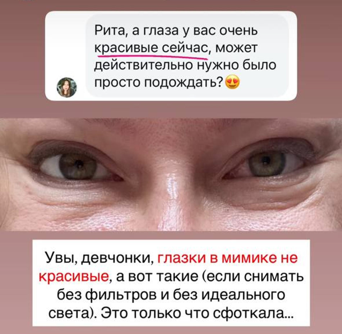    Результат пластической операции. Скриншот: Instagram (запрещён в РФ) @ritadakota
