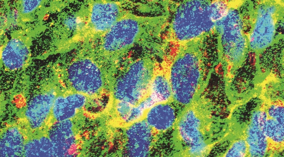   Du et al. / Science Translational Medicine, 2025