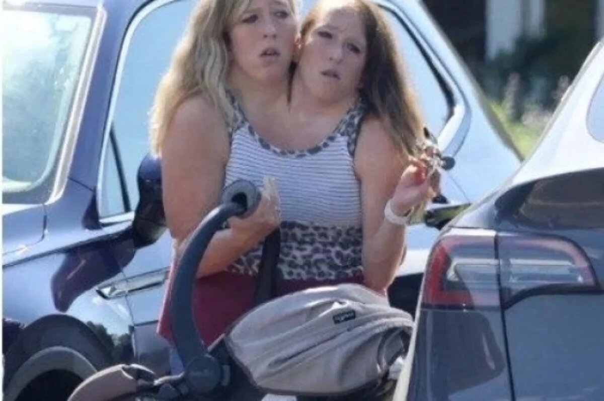    Сиамские близнецы Эбби и Бриттани Хенсел впервые стали мамами