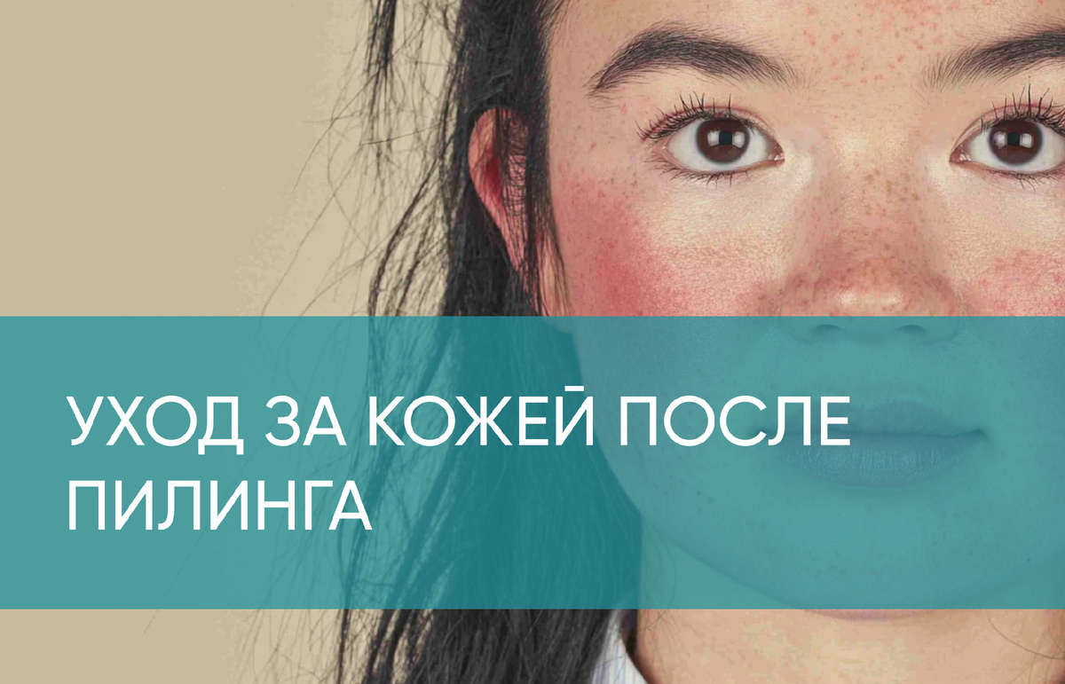 Уход за кожей после пилинга