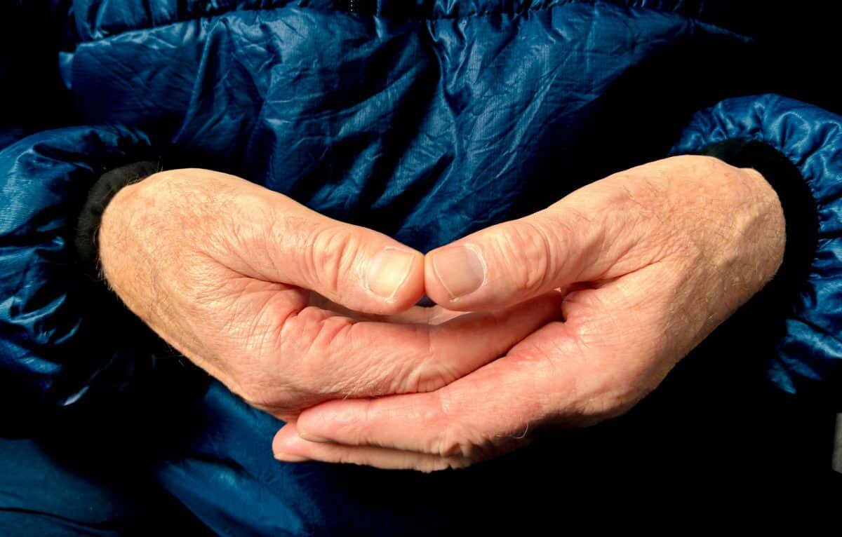 Российские ученые обнаружили клетки-виновники воспаления при артрите / ©   
 Bill Eccles, unsplash.com📷
