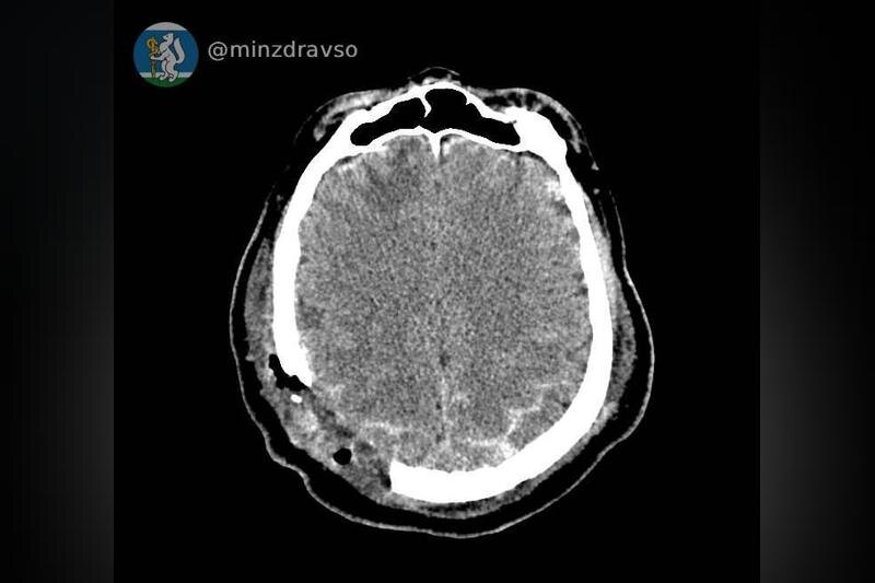   telegram-канал «Здоровье уральцев|Минздрав Свердловской области»