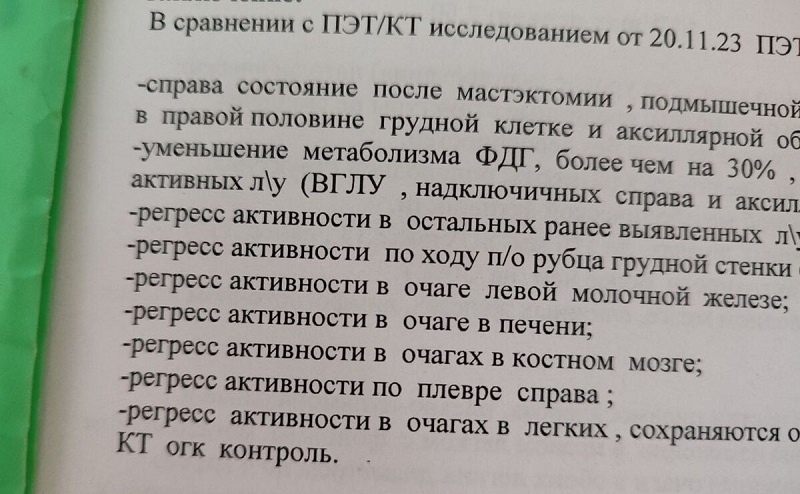 Когда слово «регресс» – благая весть 