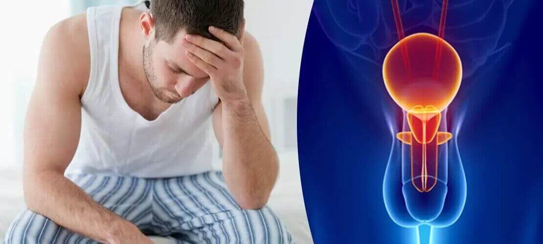 Аденома простаты у мужчин: симптомы и признаки заболевания, методы лечения гиперплазии предстательной железы. Как остановить рост гиперплазии аденомы простаты? Эффективные средства при увеличенной простате.