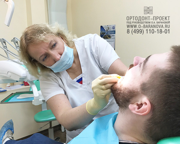 Прием ортодонта Ольги Александровной Барановой 