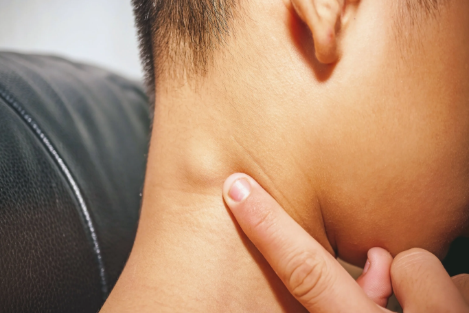 Как отличить обычное воспаление лимфоузлов от рака?