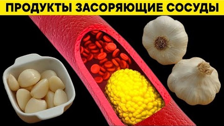 Кардиолог назвал продукты, которые разрушают сосуды