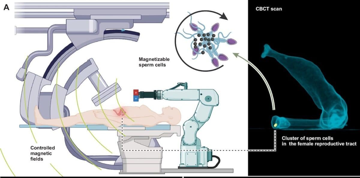    Биогибридные микророботы на основе сперматозоидов для малоинвазивного лечения женских репродуктивных органов с использованием слабых низкочастотных контролируемых внешних магнитных полей и рентгеновской флюороскопии для локализации кластеров намагничивающихся сперматозоидов / © Veronika Magdanz et.al./npj Robotics (2025). DOI: 10.1038/s44182-025-00044-1
