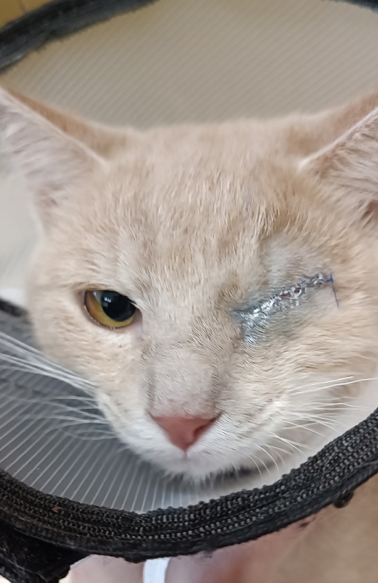 Всё прошло хорошо, теперь остатки глаза не будут воспаляться и болеть