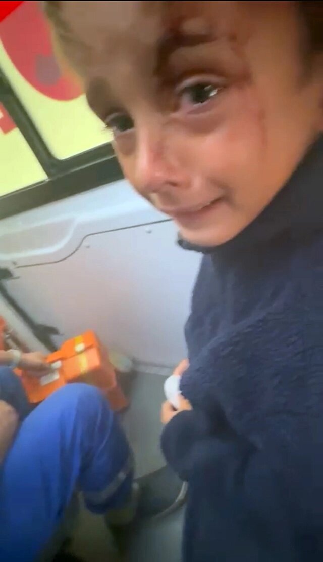    Сейчас жизнь ребёнка вне опасности, но последствия — и физические, и психологические — останутся надолго. Фото: Из личного архива