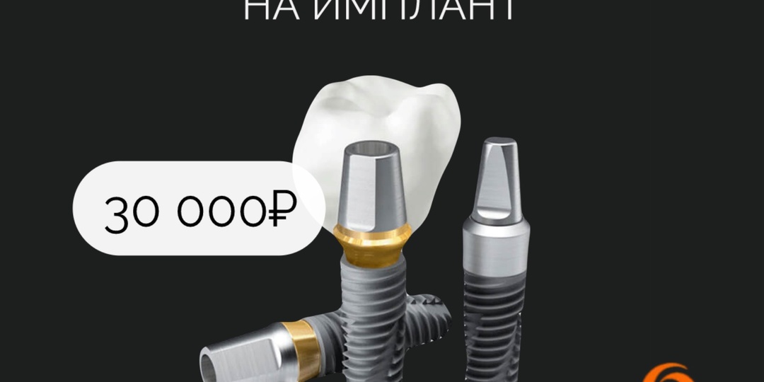Сколько стоит имплант?