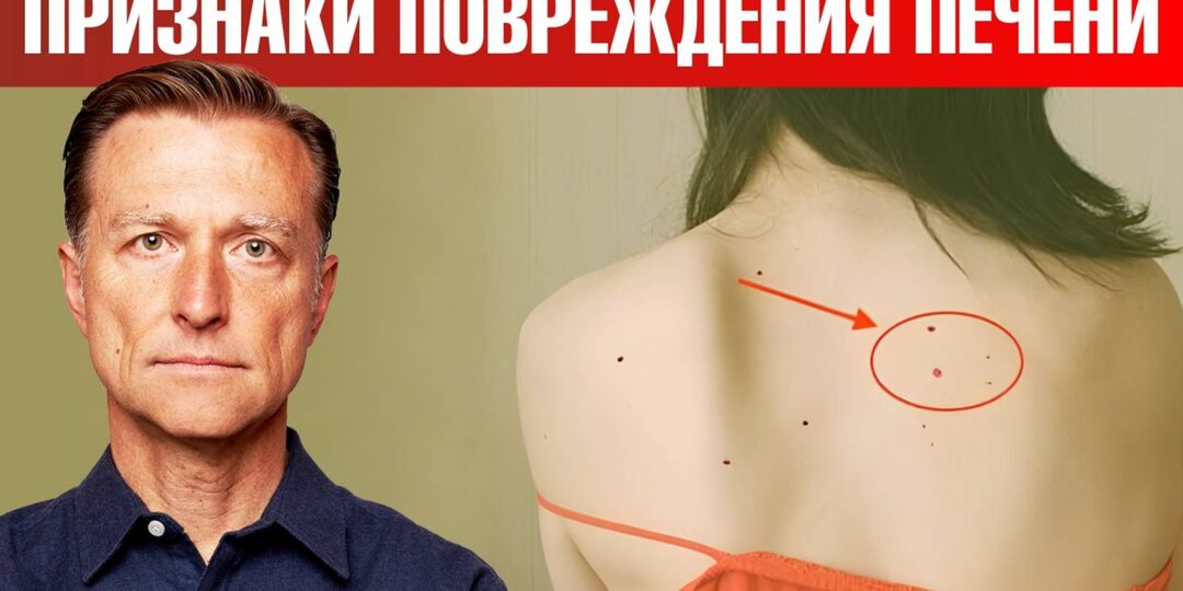 5 скрытых признаков рака печени