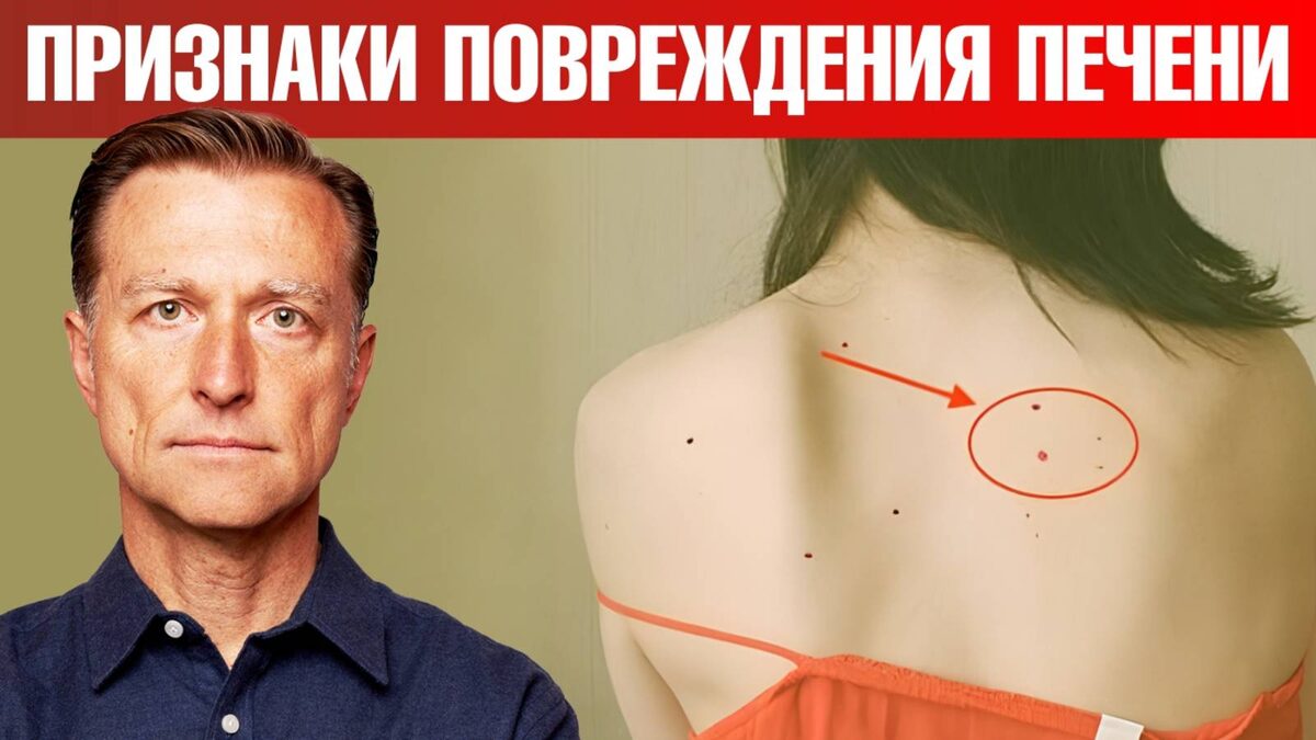 5 скрытых признаков рака печени