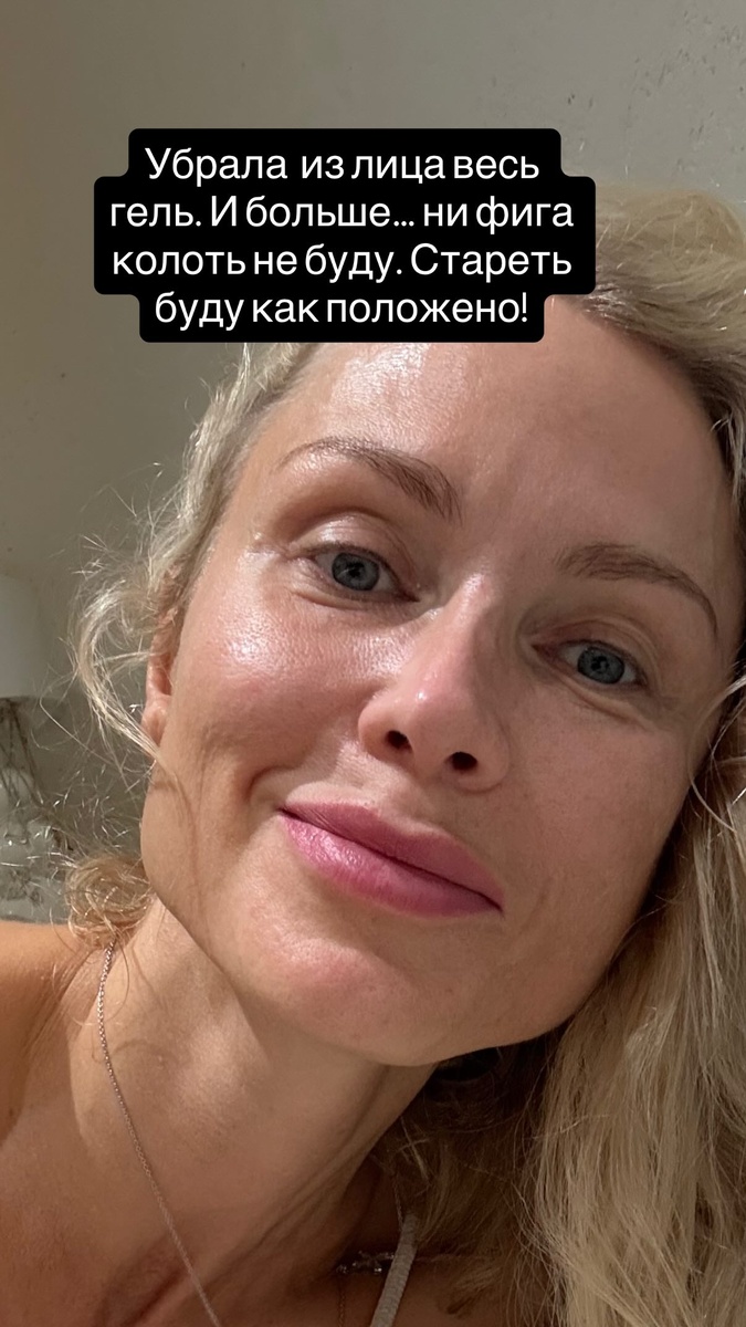    Катя Гордон показала лицо без макияжа и фильтровСоцсети Кати Гордон