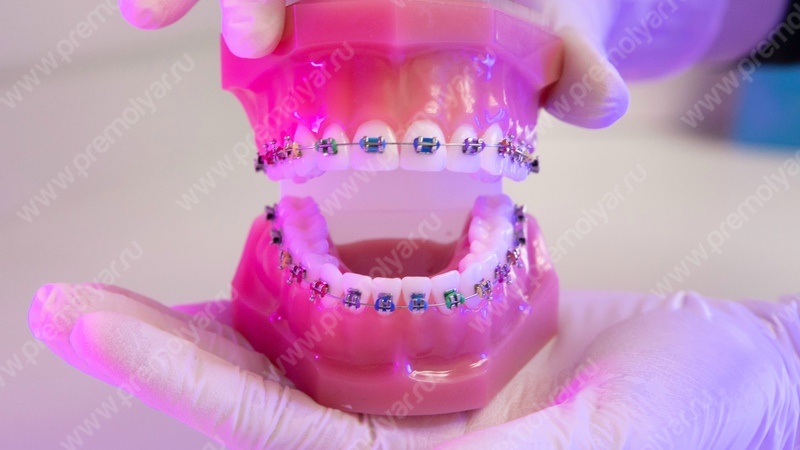 Стоматология Премоляр