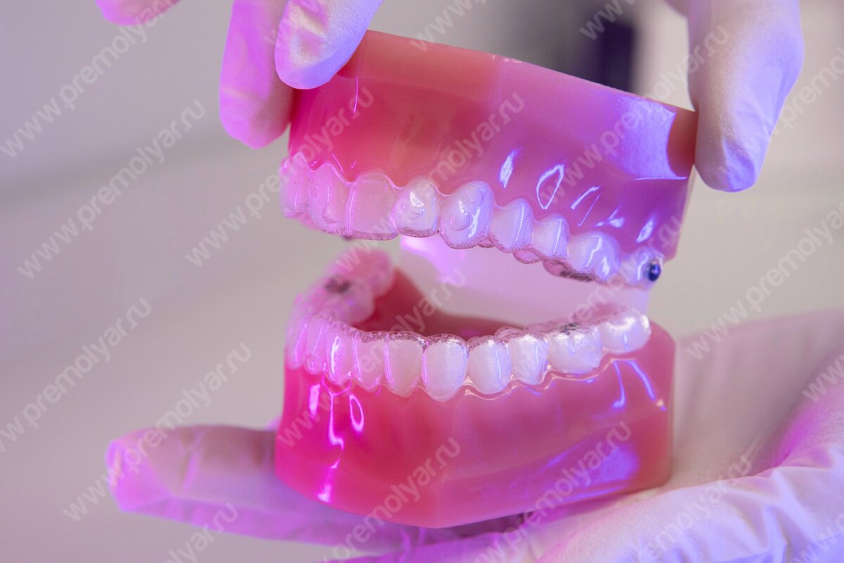 Стоматология Премоляр