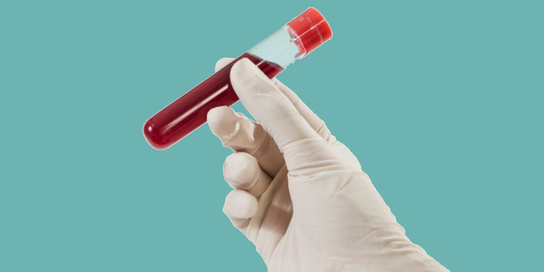 Врач объяснил, какие анализы крови спасают жизнь