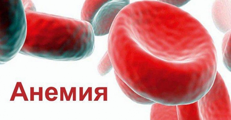 Анемия: почему вы ходите как «выключенный» и как вернуть себе энергию