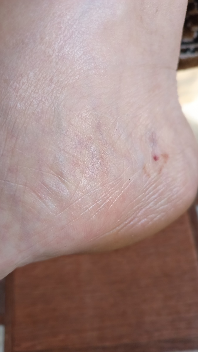 фото автора: вот это место, куда делали