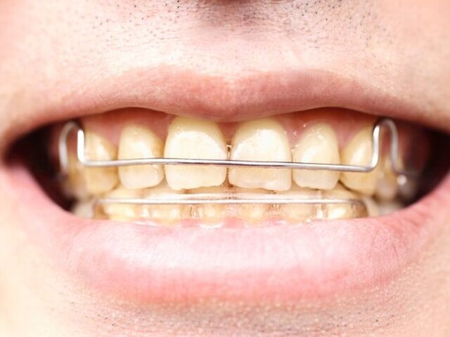    Фото: depositphotos/paylessimages