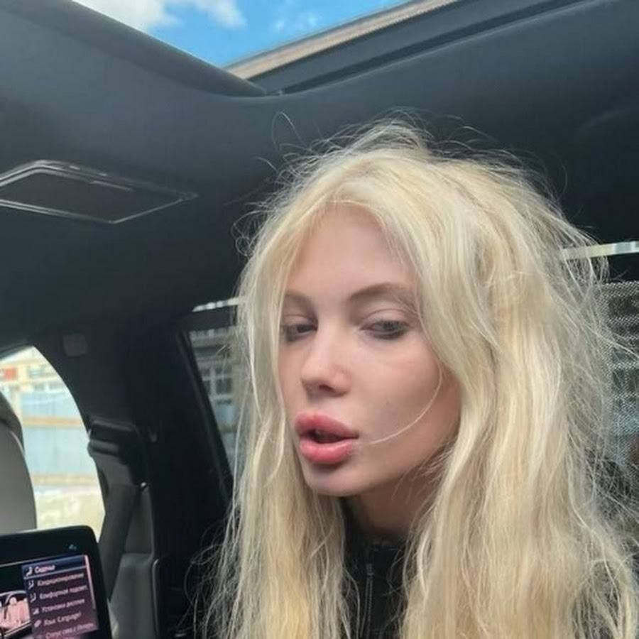 -2