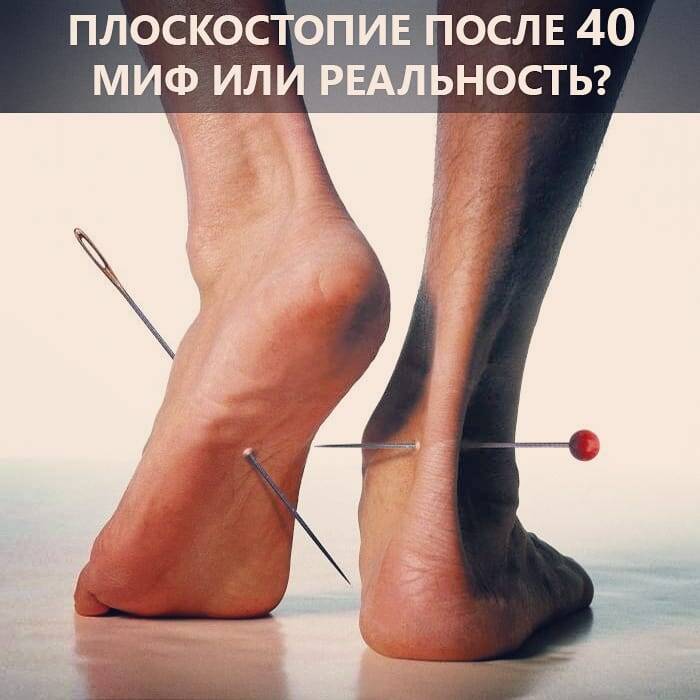 Ортопедические стельки 