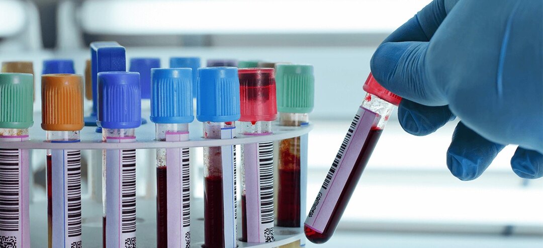 8 самых необходимых анализов после 40 лет: как проверить своё здоровье и не пропустить болезнь на ранней стадии