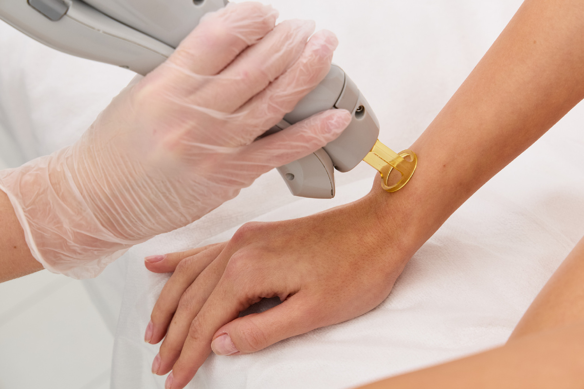 Лазер, который меняет правила игры 💖