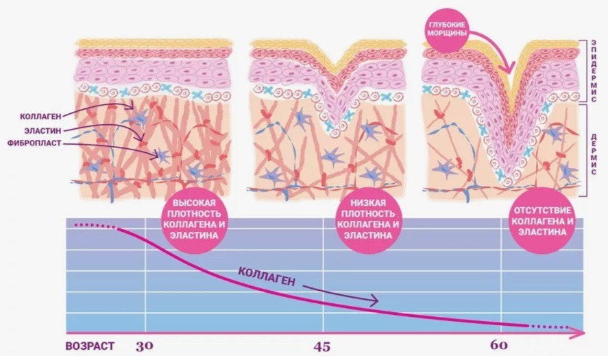 Иллюстрация взята из открытого интернет-источника