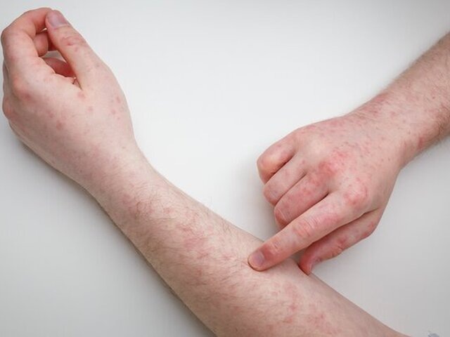    Фото: 123RF/olenaseiryk