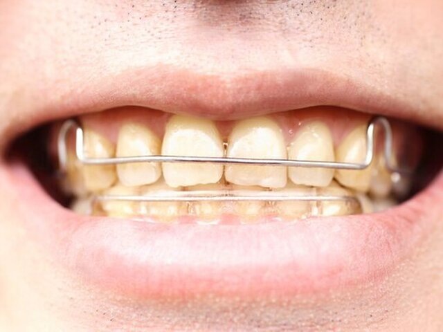    Фото: depositphotos/paylessimages