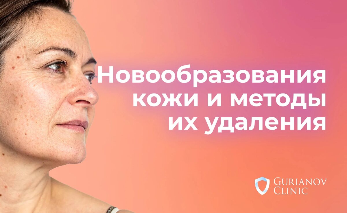 https://gurianov-clinic.ru/novoobrazovaniye