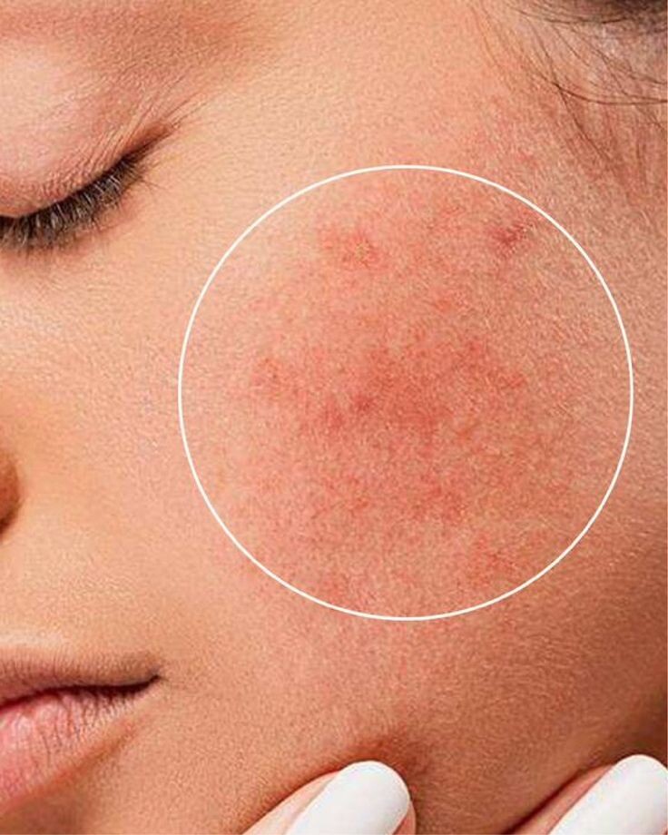 Фото: pinterest.com