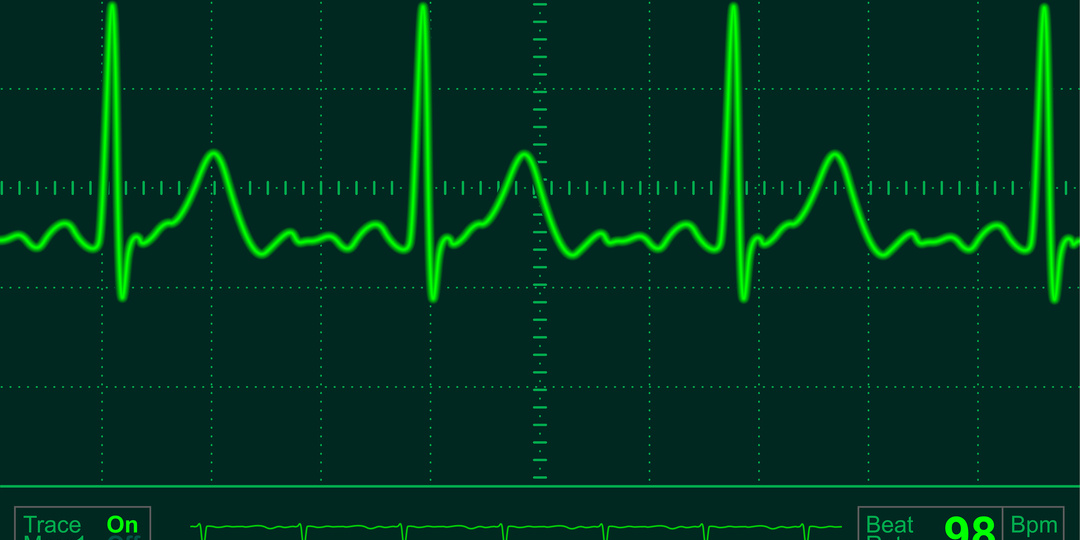 3 сигнала сердца, которые часто путают с усталостью
