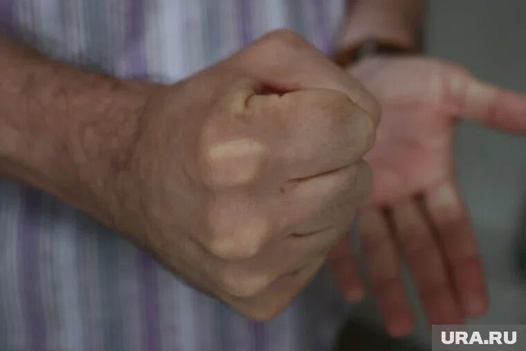 Купировать приступ эпилепсии тюменец решил кулаками. Фото: Екатерина Сычкова © URA.RU