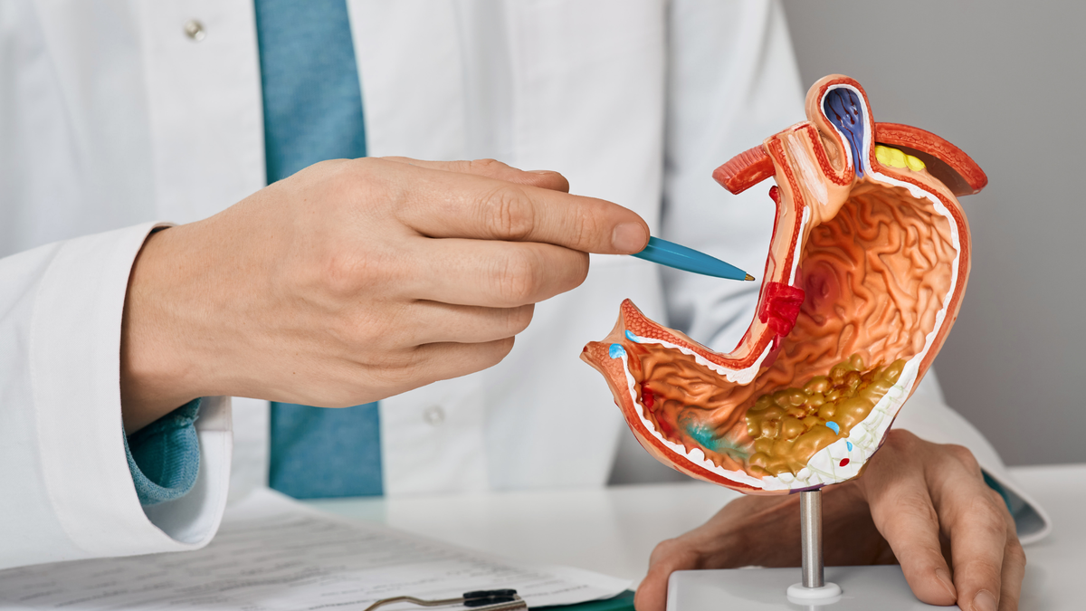 язва желудка