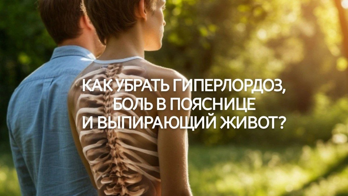 Как убрать гиперлордоз, боль в пояснице и выпирающий живот?