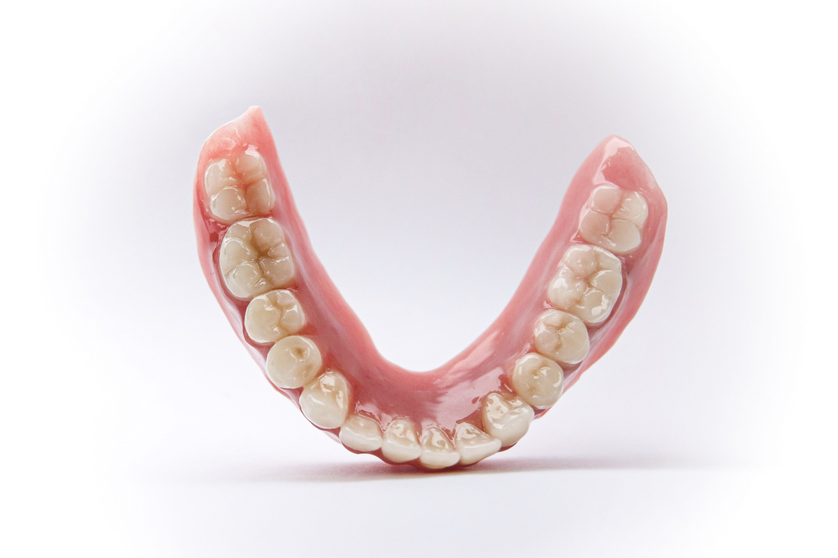 Зубной протез на имплантах на шаровидных абатментах.