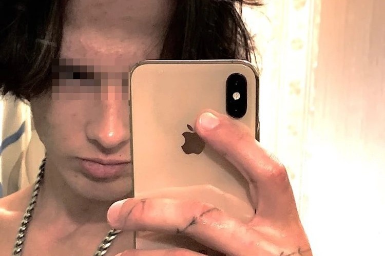 Пытался убить и себя, но не смог. Фото: КП-Санкт-Петербург