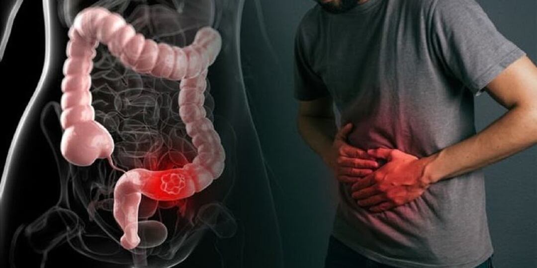 4 тревожных признака проблем с кишечником