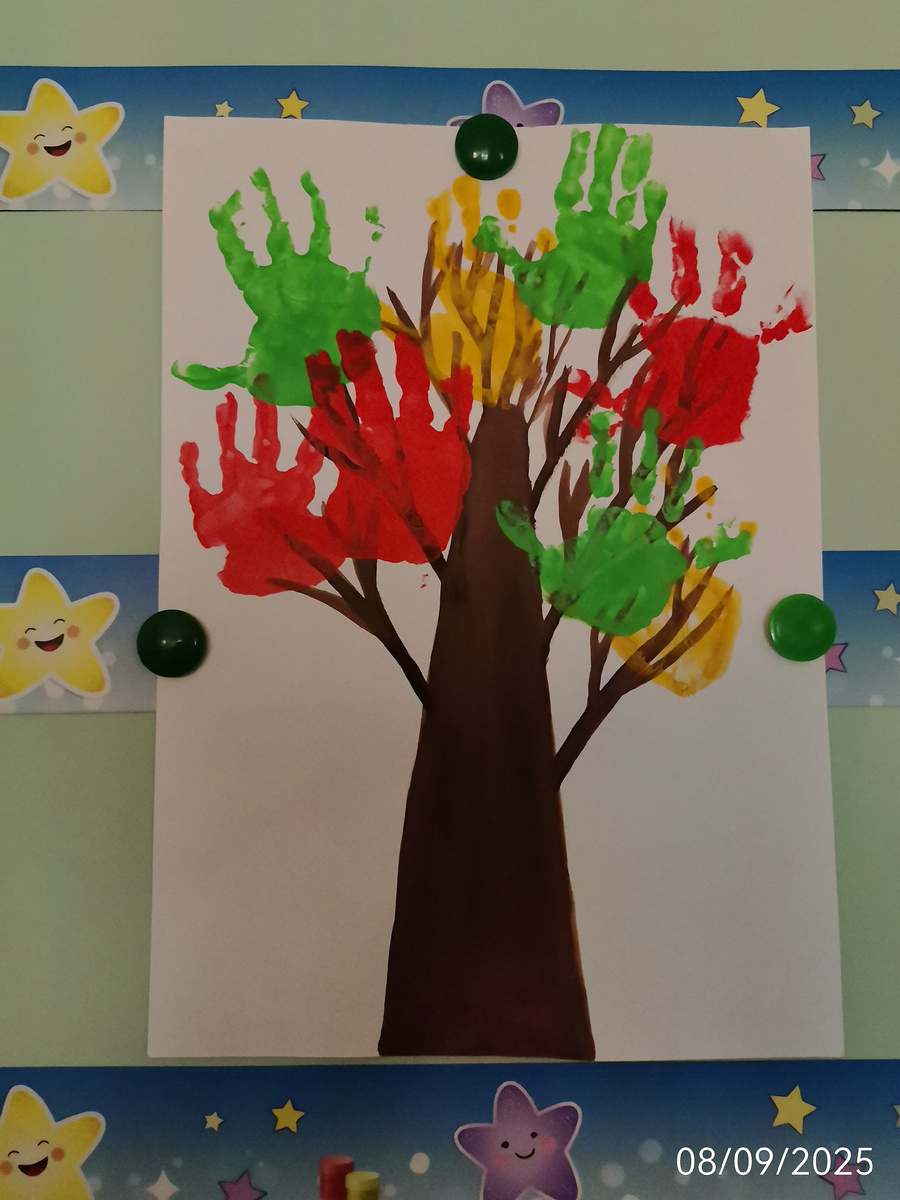 Костина рука желтая