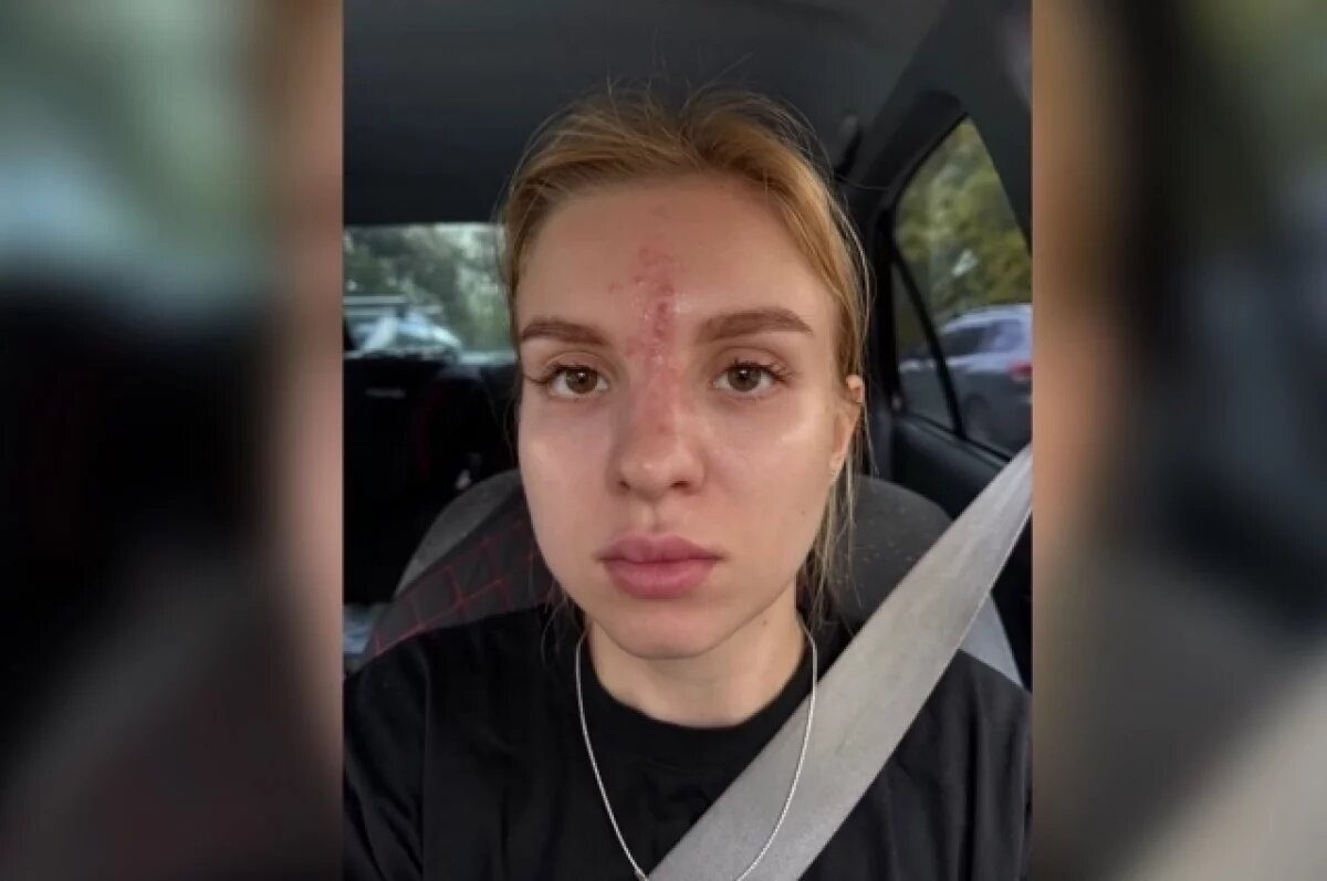    Покрылась волдырями, остался шрам.