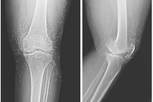     / Источник: © The New England Journal of Medicine