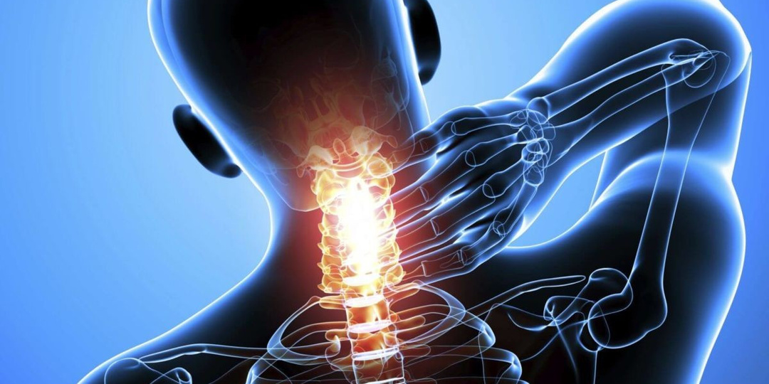 Хрустит шея и кружится голова? Не спешите списывать на усталость — это может быть остеохондроз шейного отдела