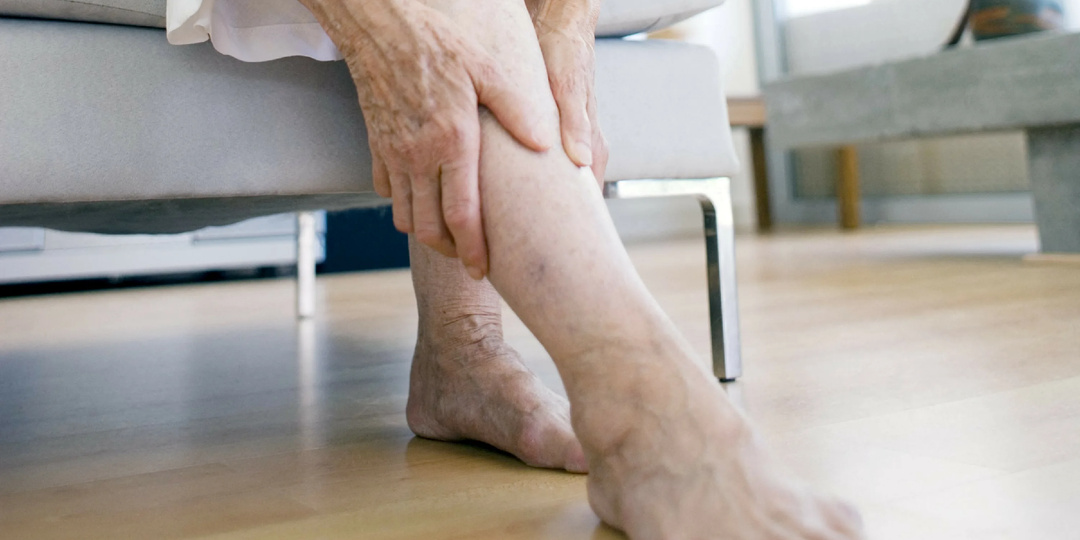 ⚠️ ОТЕКЛА НОГА — ЭТО УСТАЛОСТЬ… ИЛИ СИГНАЛ SOS? Как понять, когда можно отдохнуть, а когда — вызывать скорую .Полный гид от флеболога